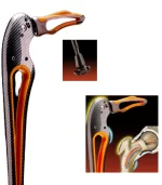 Bastón Tucane para adulto con diseño similar a la cadera humana - Image 3